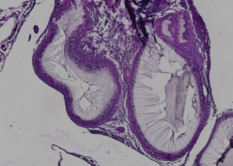 Standard Encapsulation – Immune Rejection Microscopy showing immune rejection of encapsulated cells.