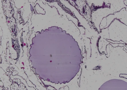 CSS® Encapsulation – Protected Delivery Microscopy of cells encapsulated with Likarda's CSS® hydrogel with minimal immune infiltration.