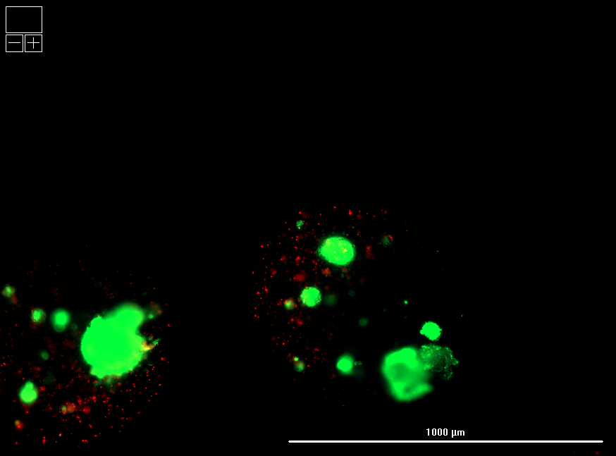 Microscopy image of intact islets (green) in microspheres within polymer formulation 2 showing better cell survival.