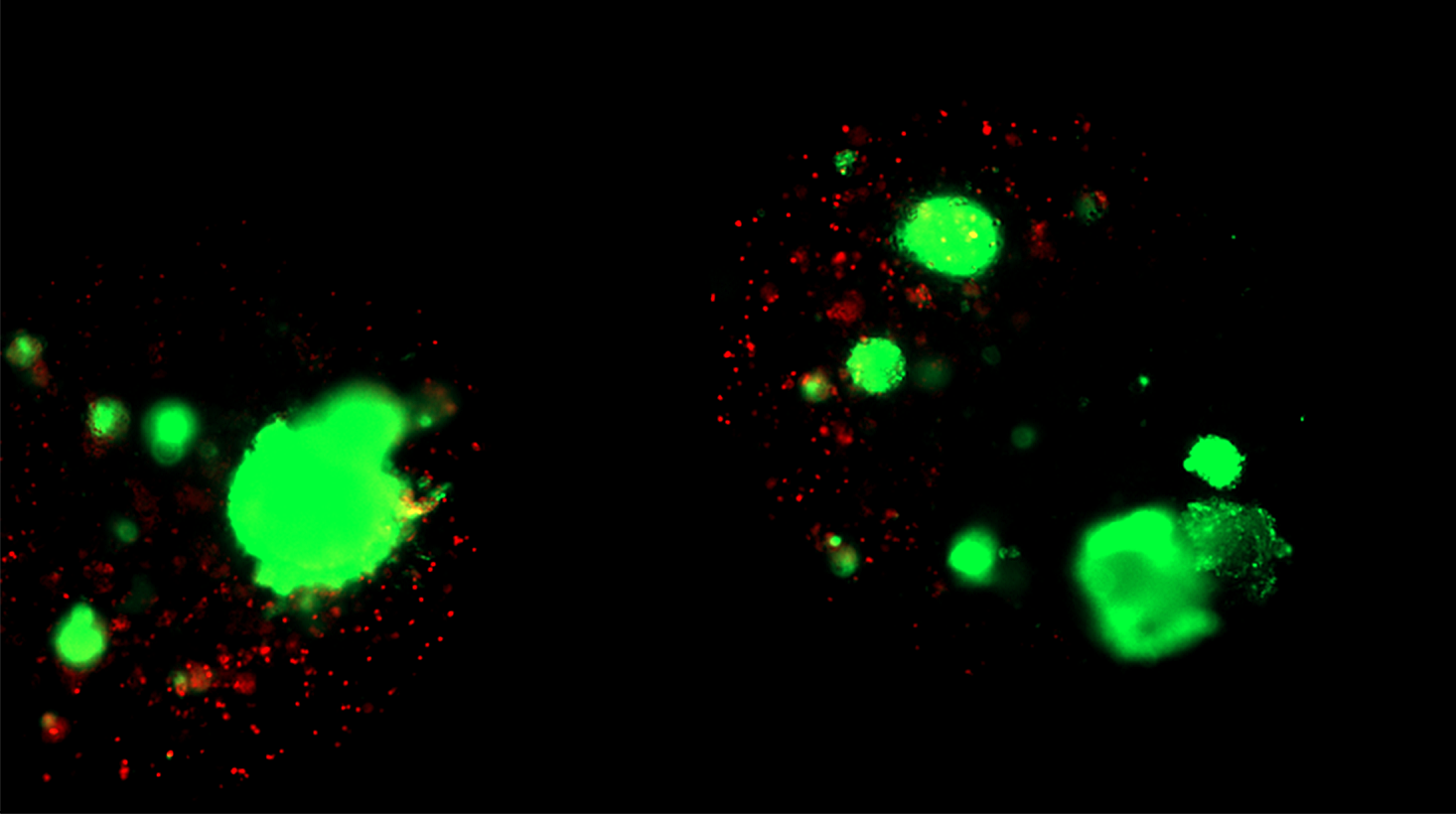 Microscopy image of intact islets in microspheres within polymer formulation 2 showing better cell survival.