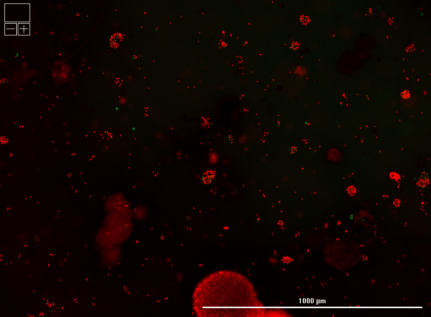 Microscopy of human islets (red) that do not survive standard cryopreservation.