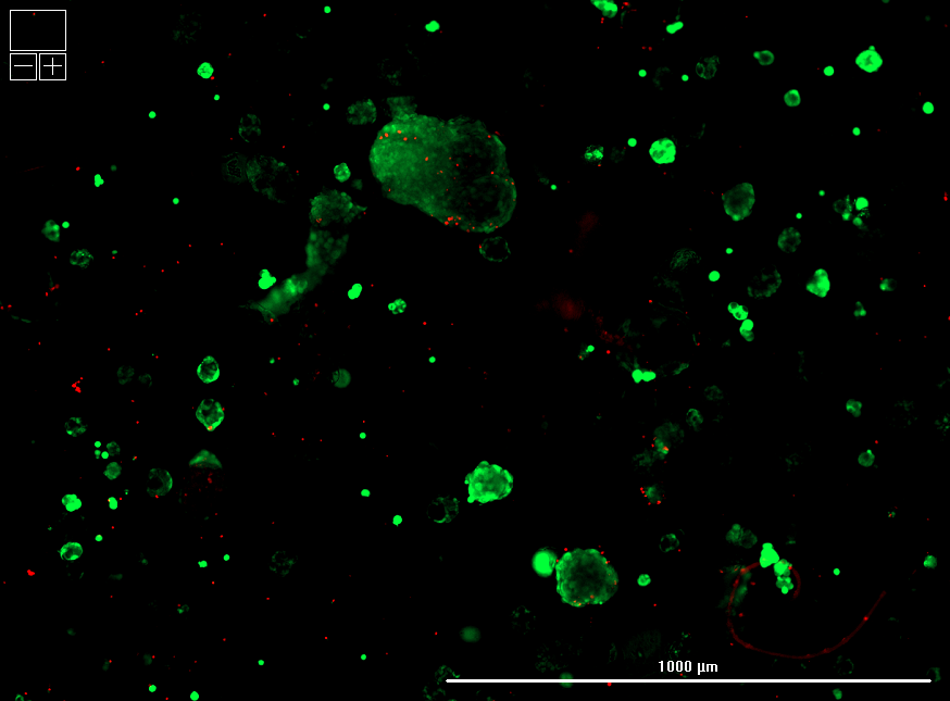 Microscopy of Intact human islets (green) before cryopreservation.